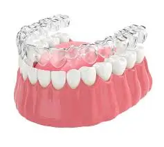 Invisalign Treatment