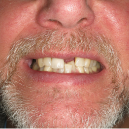 transformations-gatley-1 transformations gatley