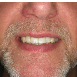 transformations-gatley-2 transformations gatley