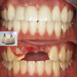 transformations-gatley-3