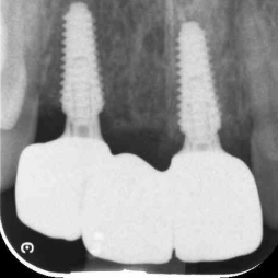 transformations-gatley-4